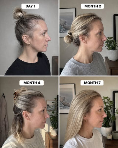 Day 1 vs day 30.
